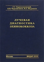 Лучевая диагностика эхинококкоза артикул 317b.